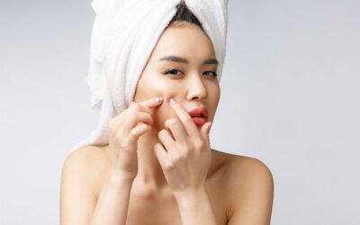 Die 5 besten Insidertipps gegen Hautunreinheiten